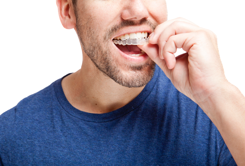 Man in a blue t-shirt inserting an Invisalign® tray onto his top row of teeth