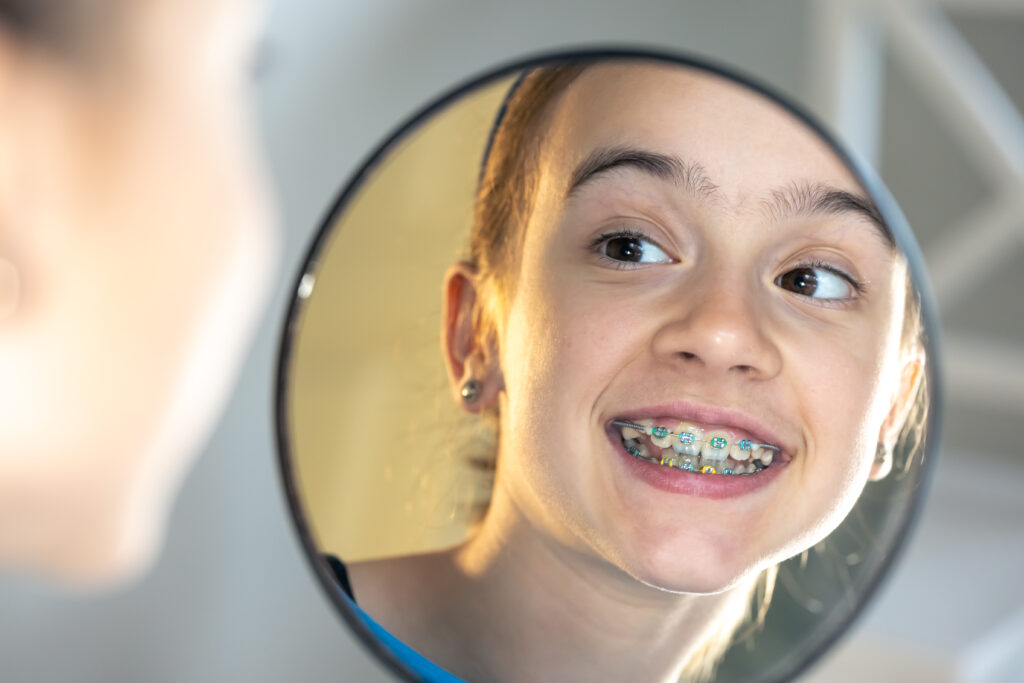 Young teen examining her cerulean braces in the mirror